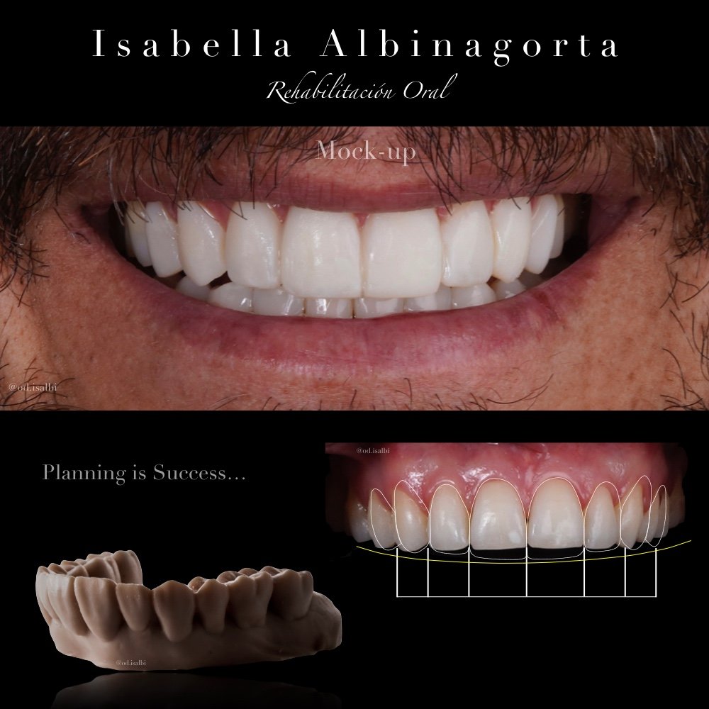 Especialista en diseño de sonrisa
